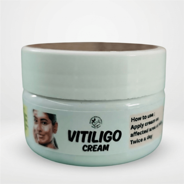 Vitiligo Cream